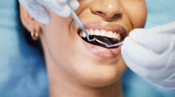 Best Emergency Denture Repair in Holly Springs, GA